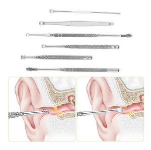 Glamza 6pc Ear Wax Removal Kit with Case